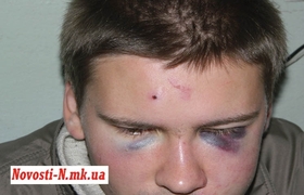 раненый Александр Влащенко