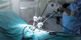 Mykolaiv will purchase a laparoscopic rack for hospital #3, photo from open sources