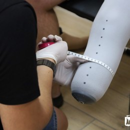 German prosthetists will work in Mykolaiv, photo: city council