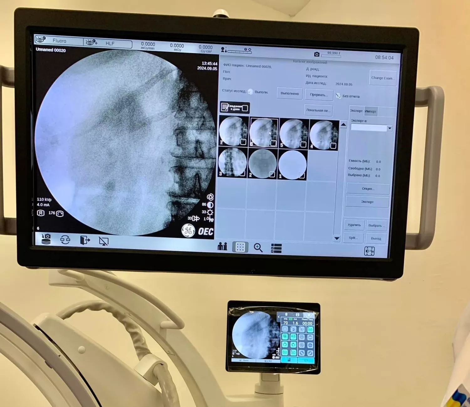 New surgical X-ray machine. Photo: Mykolaiv City Hospital No. 3