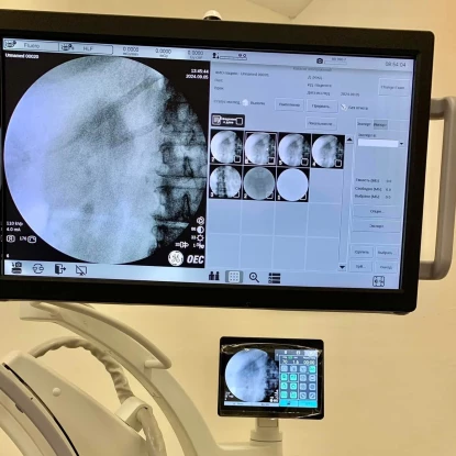 New surgical X-ray machine. Photo: Mykolaiv City Hospital No. 3