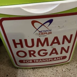 В Одесі медики провели одразу три трансплантації. Фото: Одеська МВА