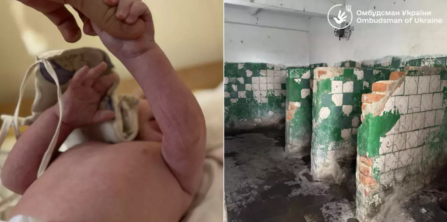 Немовля, у якого після виявили набряки на руках після того, як його фіксували ременем до візку. Фото: Офіс омбудсмана