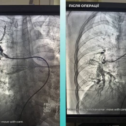Хірурги в Одесі провели унікальну операцію. Фото: Одеська міська рада