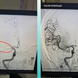 Хірурги в Одесі провели унікальну операцію. Фото: Одеська міська рада