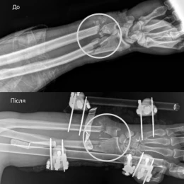 У Львові лікарі провели складну операцію. Фото: Перше медоб'єднання Львова
