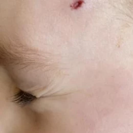 Дитина травмувалася на аварійному майданчику в Миколаєві. Фото: Юлія Романова