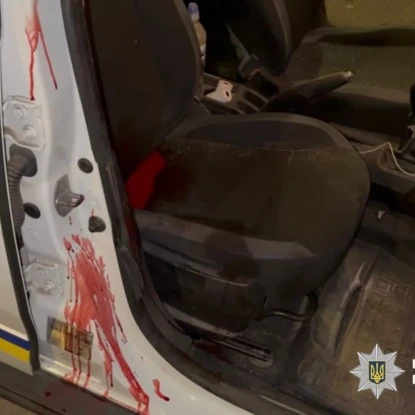 В Одесі чоловік із автоматом поранив двох поліцейських. Фото: Нацполіція