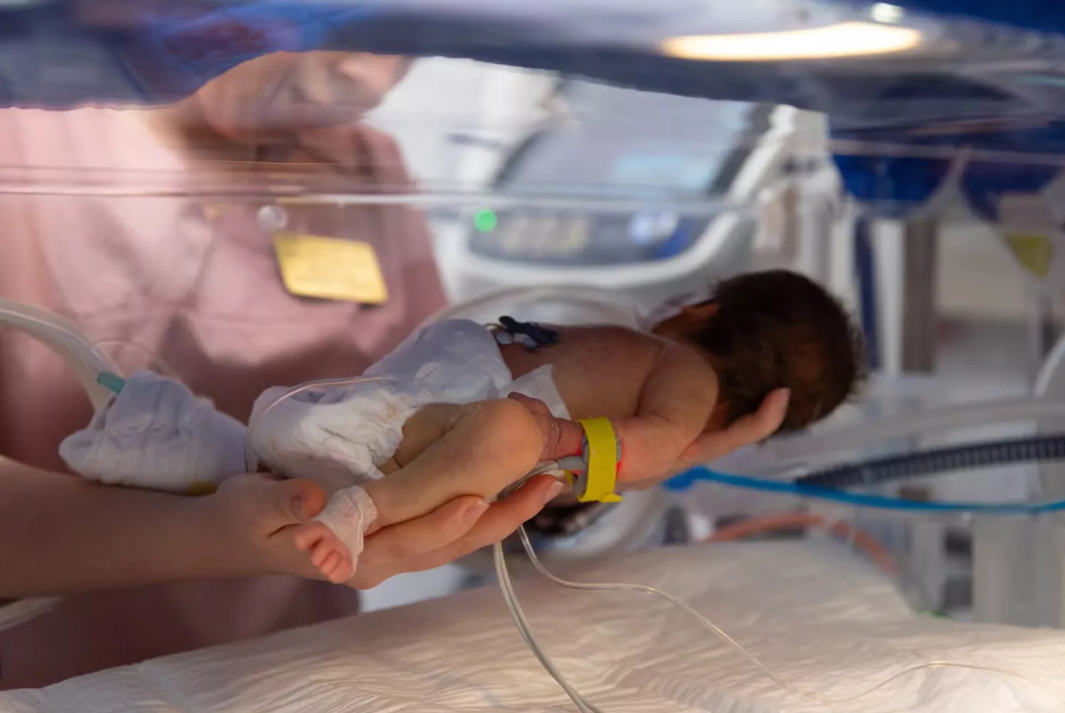 Немовля в інкубаторі. Ілюстративне фото: UNFPA