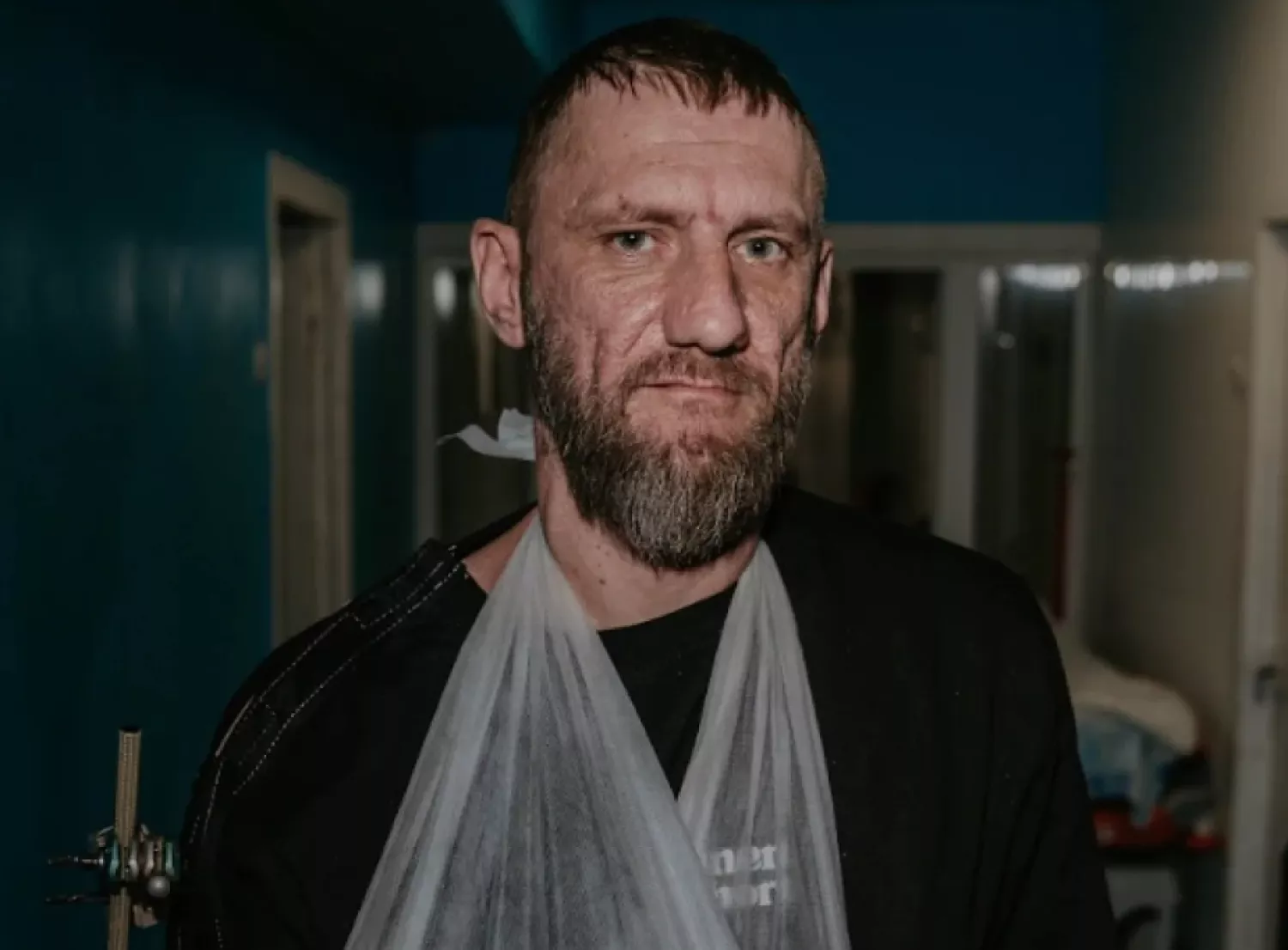 У Черкасах врятували руку військового, який після поранення пройшов 25 км до евакуації. Фото: NV