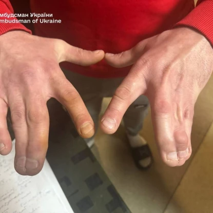 Моніторинг Ужгородського ТЦК. Фото: Дмитро Лубінець