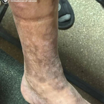 Моніторинг Ужгородського ТЦК. Фото: Дмитро Лубінець