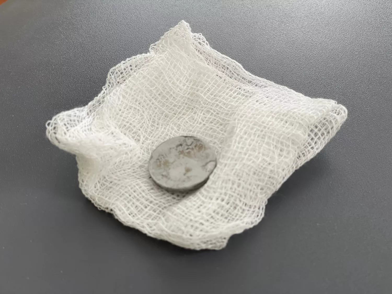 У Львові лікарі врятували дівчинку, яка кілька місяців жила з батарейкою у стравоході. Фото: Дитяча лікарня Святого Миколая