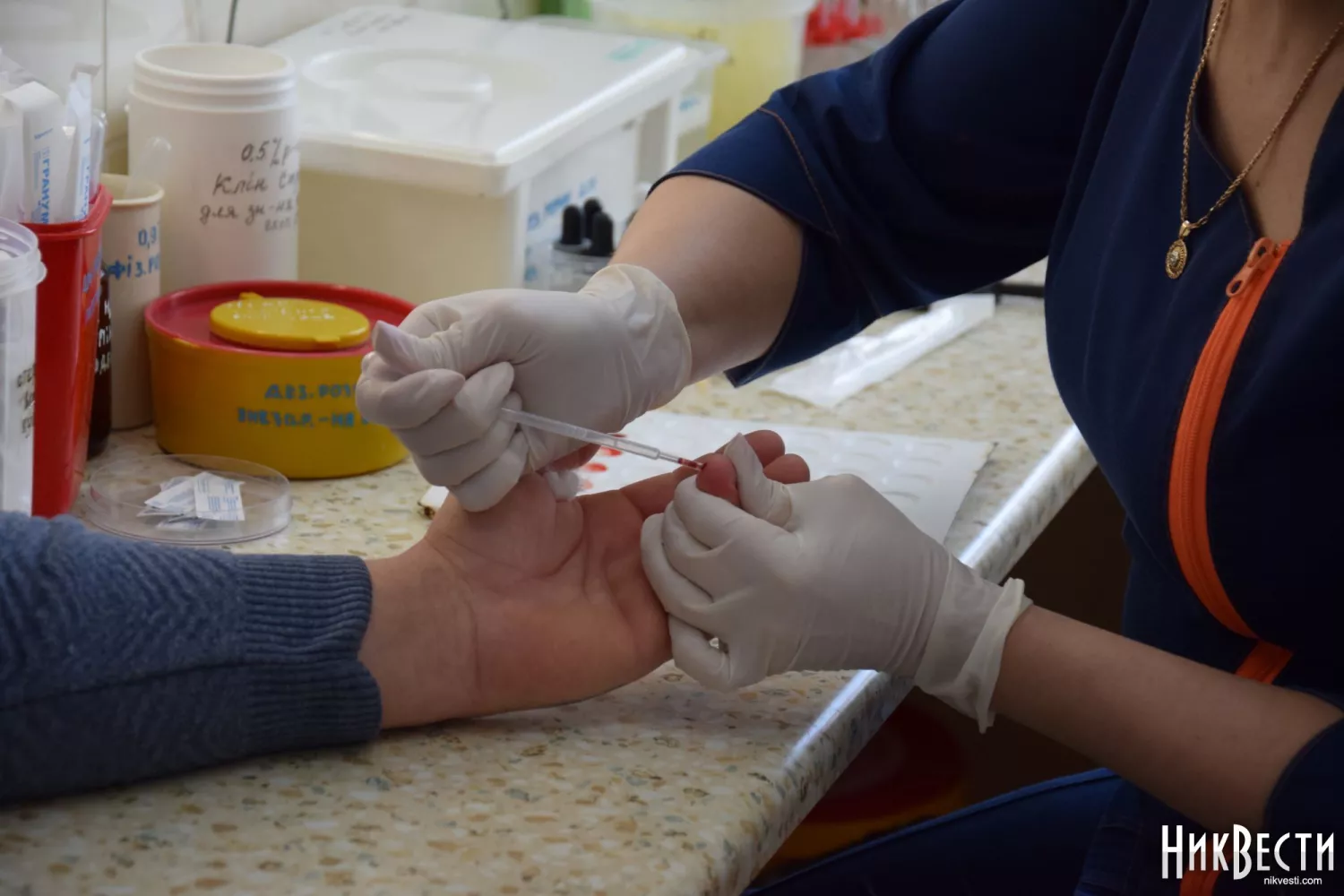 Лабораторні дослідження у станції переливання крові. Архівне фото: МикВісті