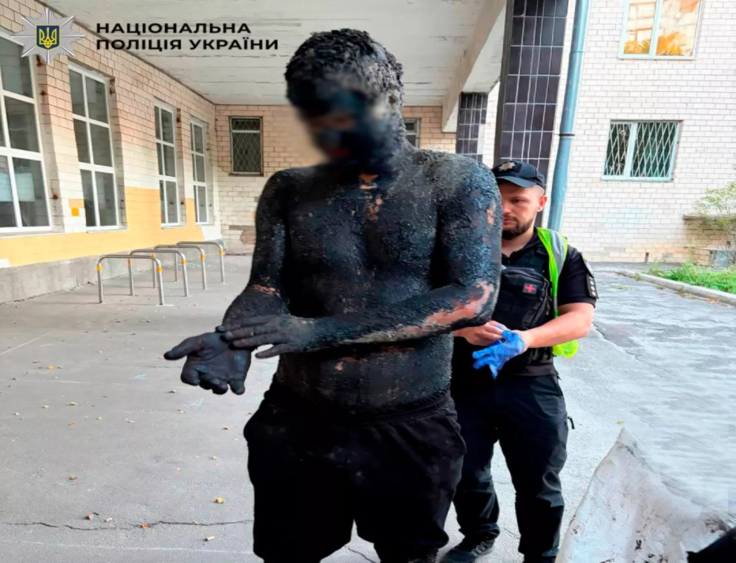 Киянин обмазався смолою перед крадіжкою у магазині. Фото: Нацполіція