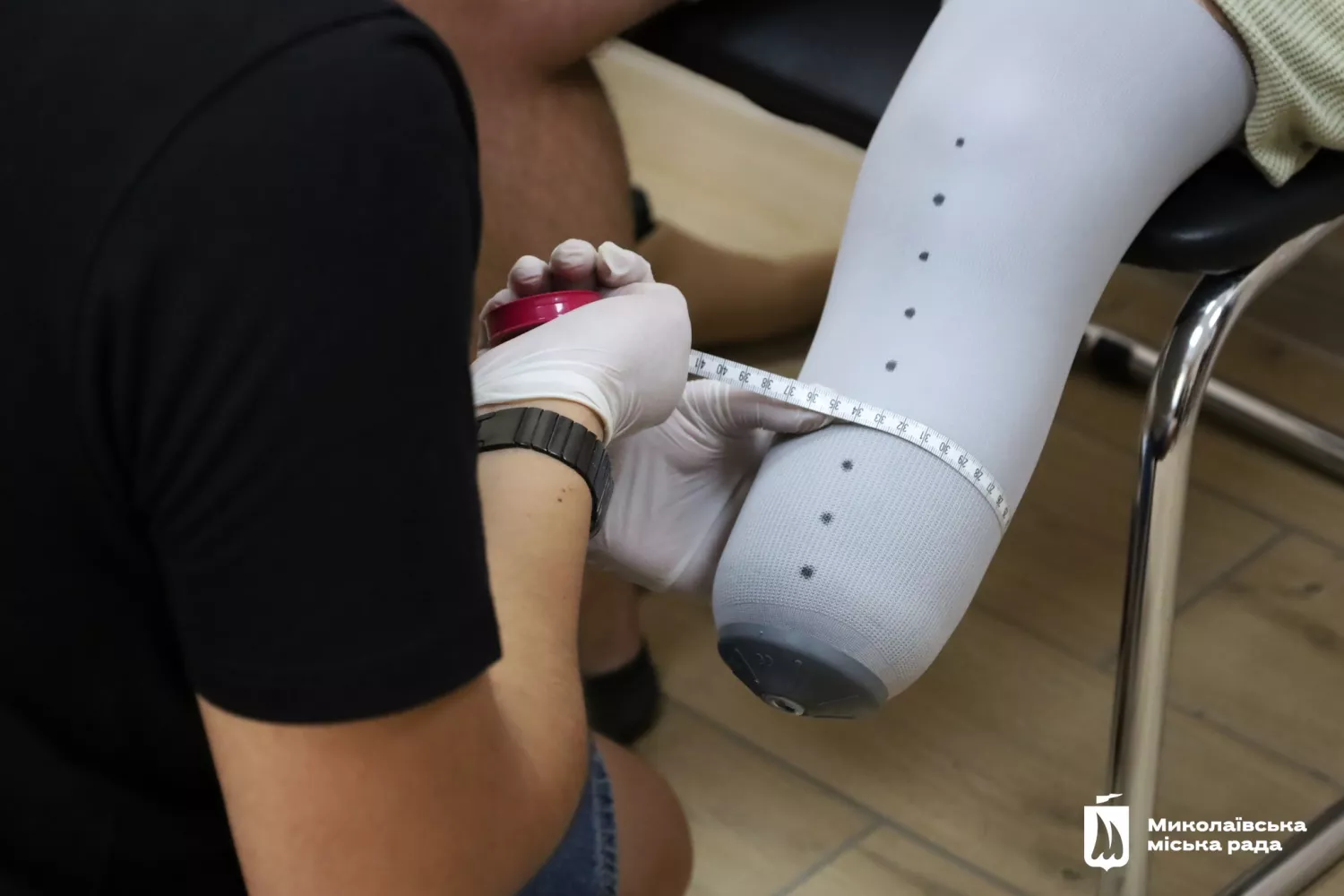 Фахівці компанії «Horus Prosthetics GmbH» займаються протезуванням у Миколаєві, фото: міська рада