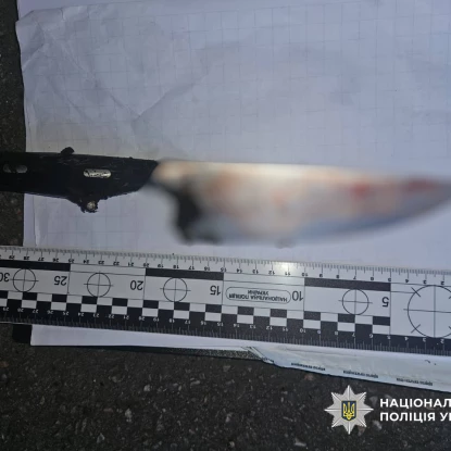 В Одесі 19-річного чоловіка затримали за підозрою у вбивстві 16-річного хлопця. Фото нацполіція