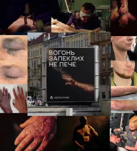 Постраждали від війни миколаївці можуть безкоштовно отримати лікування наслідків поранень